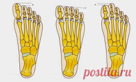 tru-knitting: Носочный мысок для римской и египетской стопы
