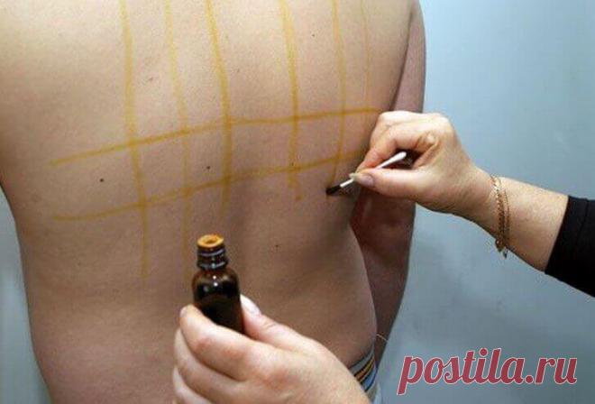 Йодная сетка: как, кому и зачем Йодная сетка раздражает рецепторы, расположенные на коже, и провоцирует ответную рефлекторную реакцию внутренних органов .Основоположником «рисования сеточек» считают питерского врача И. Колбасенко, оставившего множество научных работ в поддержку йодотерапии.