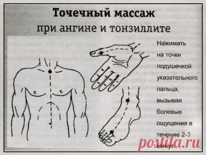 Точечный массаж при ангине и тонзиллите