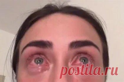 Девушка впервые нарастила ресницы в салоне красоты и попала в больницу. Пользовательница сети Джем (фамилия неизвестна) с никнеймом gembethan впервые нарастила ресницы в салоне красоты и попала в больницу. Девушка решилась на данное преображение за день до вылета на Ибицу, где собиралась отдохнуть. При этом на утро после процедуры она проснулась с покрасневшими глазами.