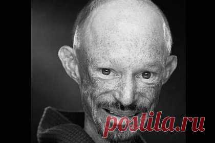 Умер актер из «Игры престолов». Британский актер, исполнитель роли пастуха в сериала «Игра престолов» Даррен Кент скончался в возрасте 36 лет. Об сообщает агентство Carey Dodd Associates в социальной сети Х (бывший Twitter). Актер скончался в пятницу, 11 августа, в окружении родителей и лучшего друга.