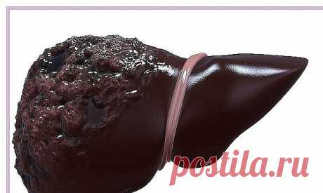 Очень простой и дешёвый способ восстановить печень. Рецепт проверен на больных циррозом печени, даже осложнённым водянкой.