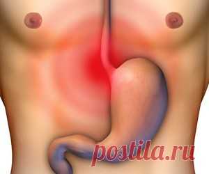 7 натуральных средств от изжоги и кислотного рефлюкса - health info