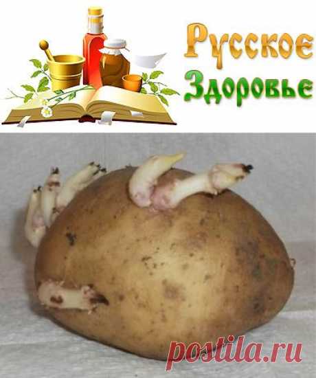 Проросшая картошка от воспаления суставов
