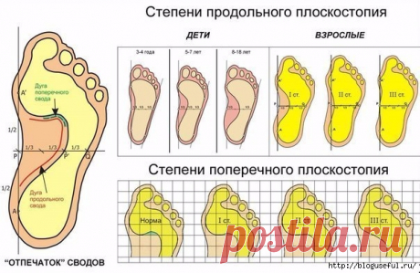 Специальные упражнения, которые помогут избавиться от плоскостопия