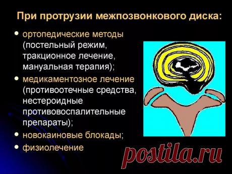 причины болей в спине факты: 9 тыс изображений найдено в Яндекс.Картинках