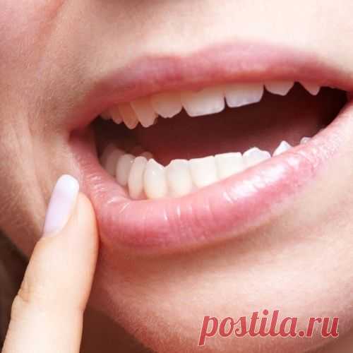 Из-за чего появляются язвочки во рту и что с ними делать