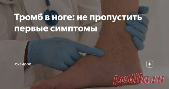 Тромб в ноге: не пропустить первые симптомы Одним из самых опасных для человека недугов считается тромбоз, который развивается на фоне нарушения кровообращения и, как следствие, закупорки вен. При этом симптомы тромба в одной из нижних конечностей в самом начале заболевания не выражены ярко. Однако, когда сгусток начинает разрастаться, ситуация требует уже незамедлительной реакции. Закупорка вены опасна, поскольку при несвоевременно