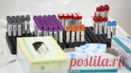 Швейцария сняла ограничения на сдачу крови гомосексуалистами