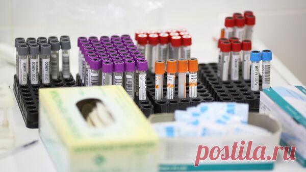 Швейцария сняла ограничения на сдачу крови гомосексуалистами