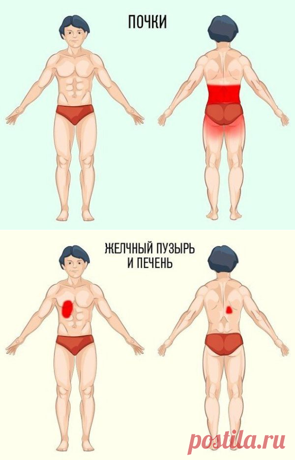 ПРИЧИНА БОЛИ И МЕСТО ЕЁ ЛОКАЛИЗАЦИИ