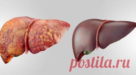 Эти 6 продуктов отлично помогут в детоксикации вашей печени!
