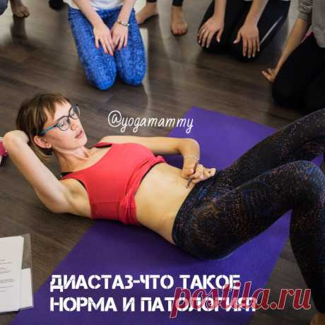 Диастаз - что такое норма и патология?. Блог YogaMammy