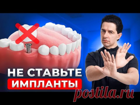 Кому нельзя ставить импланты? Стоматологи молчат об этом