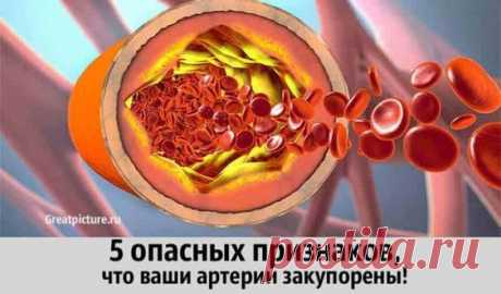 Постоянные стрессы и постоянное давление позволяют нам буквально втягивать и сжимать голову. Побалуйте себя и научитесь отдыхать! Практикуйте методы компенсации энергии – спорт, релаксационные упражнения, медитация, в зависимости от индивидуальных потребностей и интересов!