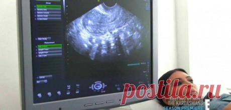 Не уж то Ким врёт? | SloveniaBusiness &amp; Living