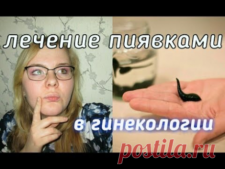 лечение пиявками Гирудотерапия в гинекологии