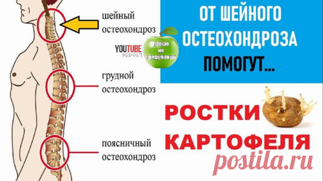 От Остеохондроза шейного отдела позвоночника помогут Картофельные ростки.
Картофельные ростки содержат много активного ядовитого алкалоида соланина, защищающего прорастающие клубни от насекомых и вредителей, губительно действующего на вирусы, грибки и болезнетворные бактерии. Картофельные ростки лечебные свойства имеют благодаря содержанию именно этого вещества. 
Соланин придает препаратам из ростков картошки обезболивающие, противовоспалительные, спазмолитические, антиалл...