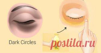 Как быстро избавиться от темных кругов под глазами.Вы будете удивлены результатами!