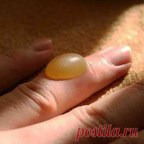 Полезные советы(если вы обожглись). | ЖЕНСКИЙ МИР