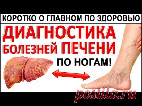Первые Признаки больной Печени! Их видно по ногам! Если Ваша ПЕЧЕНЬ НЕЗДОРОВА, то тогда вот что.