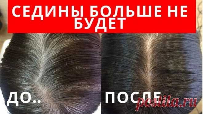 Этот сорняк избавит от седины Друзья, если вас беспокоит седина, не обязательно бежать в магазин и покупать краску для волос. Про то, что я вам расскажу и покажу буквально растет везде и не только убирает седину, но и прекрасно укрепляет волосы.✔Делитесь пожалуйста этим видео с друзьями, им тоже это пригодится!!!