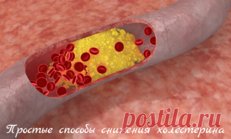 Простые способы снижения холестерина