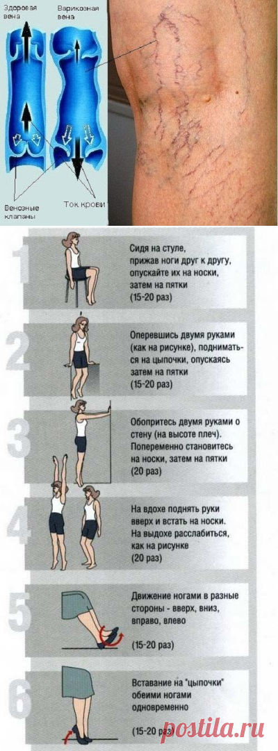 Эффективные мази при варикозном расширении вен | Правила здоровья и долголетия