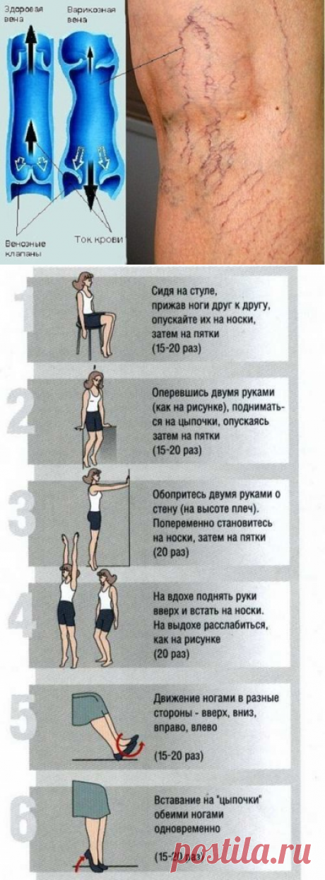 Эффективные мази при варикозном расширении вен | Правила здоровья и долголетия