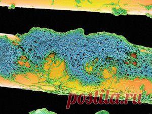 То, что таится у вас во рту, очень крупным планом