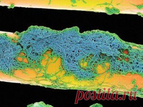 То, что таится у вас во рту, очень крупным планом