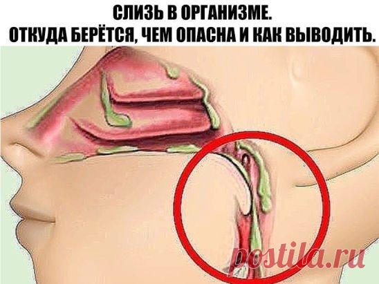 СЛИЗЬ В ОРГАНИЗМЕ. 
ОТКУДА БЕРЁТСЯ, ЧЕМ ОПАСНА И КАК ВЫВОДИТЬ. 
Впервые слизь в нашем организме образуется еще в раннем детстве тогда, когда мы съедаем что-то вареное. 
По мере того как мы растем, слизь накапливается 
и заполняет все полости нашего тела. Самым «любимым» местом скопления для слизи являются легкие, бронхи и желудок. 
Когда ее собирается слишком много, она начинает подниматься выше и выходит через нос. 
Как правило, очень часто мамы маленьких детей думают, что их чадо простудилос