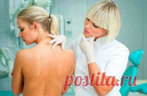 Крапивница у взрослых: фото, симптомы, виды, причины и лечение