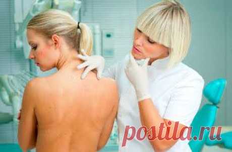 Крапивница у взрослых: фото, симптомы, виды, причины и лечение