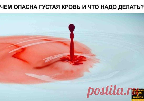 ЧЕМ ОПАСНА ГУСТАЯ КРОВЬ И ЧТО НАДО ДЕЛАТЬ?
Некоторые знают, что густую кровь надо разжижать. Замедленный кровоток приводит к кислородному голоданию внутренних органов. И к возможному образованию тромбов.
Итак, что нужно делать, чтобы кровь свободно циркулировала. Несколько простых советов.
Профилактика образования тромбов
1. Пейте больше воды! 90% людей пьют очень мало воды. Речь именно о кипяченой природной воде, а не о жидкостях. Взрослый человек должен выпивать ежедневн...