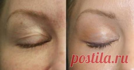 Подруга привезла из Египта рецепт: всего 3 масла, но эффект… Диву даюсь! — Копилочка полезных советов