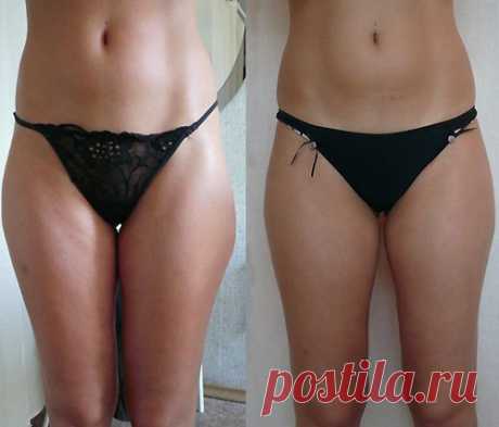 Мне удалось убедиться в том, что существуют достаточно эффективные и результативные методы для похудения. Для достижения поставленной цели в приобретении стройной фигуры просто нужно не лениться и выполнять предписания и полезные советы.Я сбросила шесть килограммов лишнего веса всего за две недели с помощью...