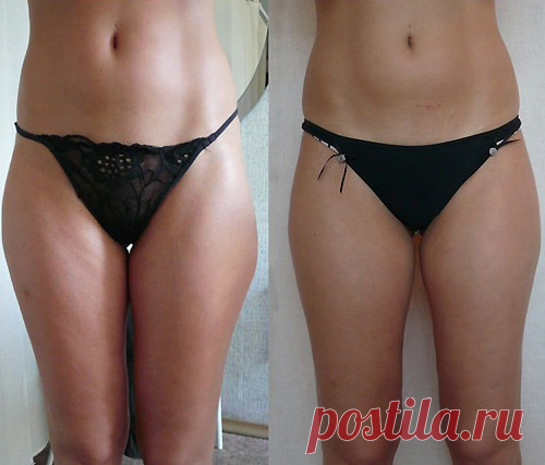 Мне удалось убедиться в том, что существуют достаточно эффективные и результативные методы для похудения. Для достижения поставленной цели в приобретении стройной фигуры просто нужно не лениться и выполнять предписания и полезные советы.Я сбросила шесть килограммов лишнего веса всего за две недели с помощью...