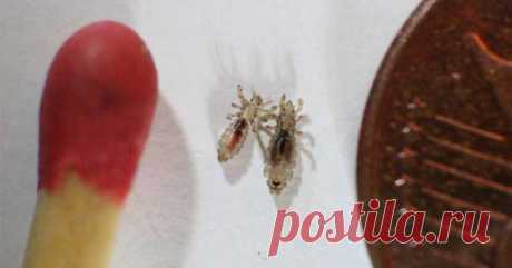 Εξαφανίστε τις ψείρες πανεύκολα και γρήγορα