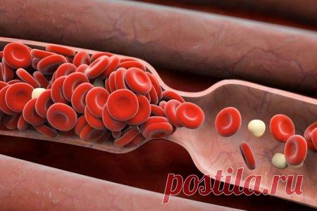 Список рецептов, продуктов и трав против густой крови и тромбов | Похмелье и борьба с ним Мы подготовили для вас народные методы, которые помогут уменьшить свёртываемость крови и снизить дурное влияние медикаментов.  Проблема густой крови и тромбозов в настоящее время стоит очень остро. Сотни тысяч людей страдают этой проблемой, болеют и умирают. Важно бороться с болезнью любыми способами, чтобы не допустить печального финала. Чтобы кровь стала жиже, кроветворения лучше, а...