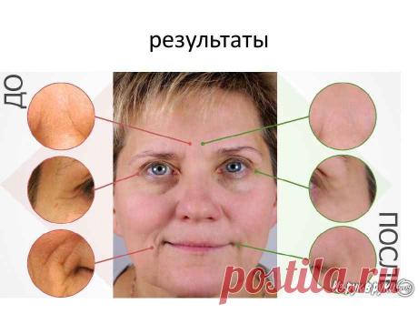 Косметика VISION Skincare: вечная молодость, по выгодным ценам, Самарская обл, Тольятти. Цена 11 667 руб. - ИЗ РУК В РУКИ