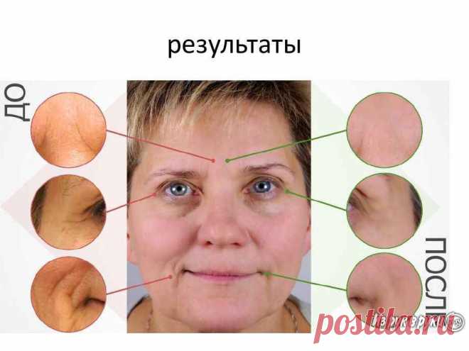 Косметика VISION Skincare: вечная молодость, по выгодным ценам, Самарская обл, Тольятти. Цена 11 667 руб. - ИЗ РУК В РУКИ