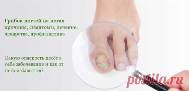 Грибок ногтей какой вред наносит организму 
Какой вред организму от грибка ногтей - Василиса Рыбакова

Какой вред организму от грибка ногтей ... Смотри как Принято считать, что грибок ногтей последствия для организма в целом не имеет никакого. ... Кроме того, инфекция наносит системный вред всему организму ...