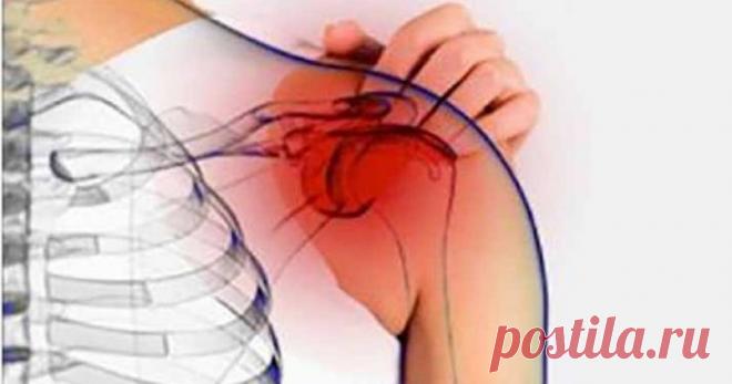 Натуральное лечение «замороженного» плеча и как его быстро исцелить 
Любой, у кого было замороженное плечо, знает, что это за ощущения. Это состояние проявляется в жесткости и боли в плечевом суставе, что обычно является изнурительным. Врачи склонны назначать различны…