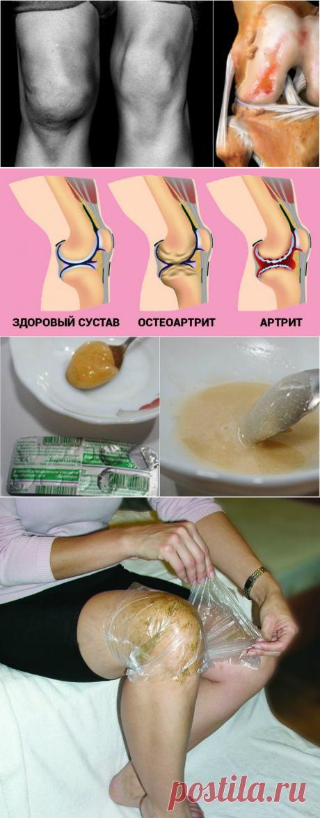 Мёд и аспирин