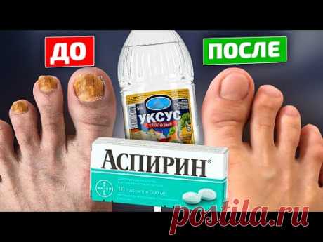 Тайное оружие фармацевтов от грибка ногтей! Уксус и аспирин