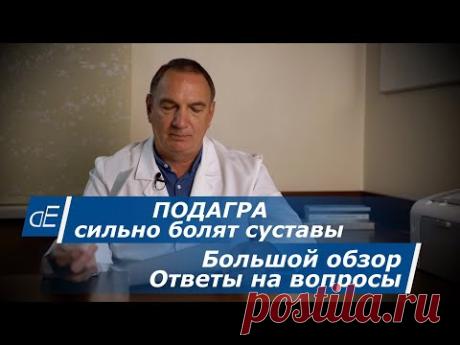 ПОДАГРА, сильно БОЛЯТ СУСТАВЫ на ногах или руках, колени и др.   Большой обзор.   ОТВЕТЫ на вопросы.