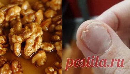 Съешьте это, если у вас ломкие ногти, бессонница и обильное выпадение волос Испытываете проблемы со сном? Волосы и кожа стали тусклыми, а ногти постоянно ломаются? Это домашнее средство способно вернуть вам здоровье и здоровый внешний вид. Ешьте по 1 ложке утром натощак! Прежде чем мы начнем с этой статьи, я хотел бы задать вам несколько простых вопросов: Есть ли у вас проблемы со сном?  Есть ли у вас ломкие ногти?  Вы испытываете потерю волос? Дамы и господа, если вы отве...