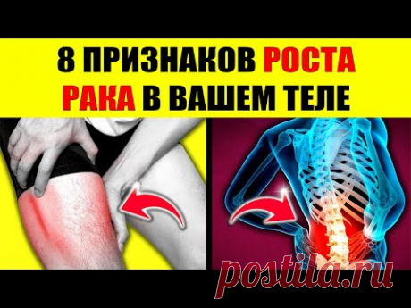 Не игнорируйте эти 8 ранних признаков рака - Это может спасти вам жизнь