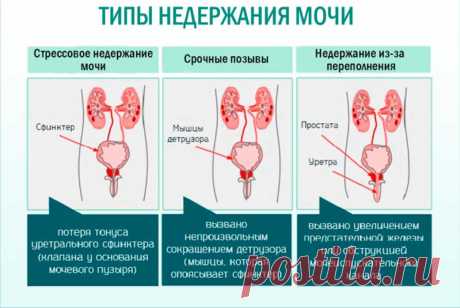 Как вылечить недержание мочи: советы врача-рефлектолога. Восточная медицина поможет!